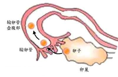 哪些症状提示患上输卵管堵塞？