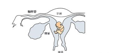 夏天如何预防和治疗阴道炎
