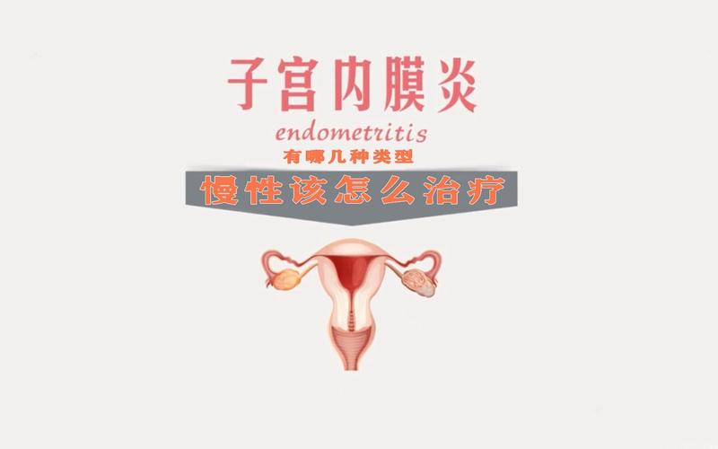 ecf989decdb8c7b6a90b89edaaff3ec2