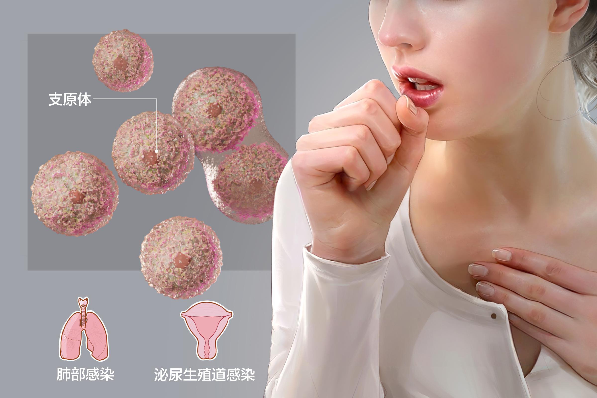解脲支原体并发盆腔炎的日常护理要点