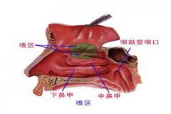鼻炎危害大 早期重视很关键