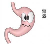 饮食不当致胃癌 防范意识不可少