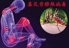 基孔肯雅热病毒最新疫情 在尼加拉瓜蔓延