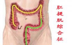 产后性生活疼痛  或是肛提肌综合征