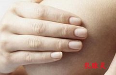 产后不分泌乳汁 请人揉却揉出乳腺炎