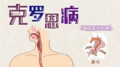 半年腹痛腹泻且还肠瘘脓肿 原是克罗恩病