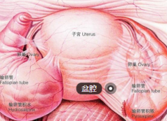 盆腔粘连分离术 术后一个月内禁止同房