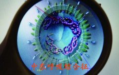韩国中东呼吸综合征增至7例 其传染源何在