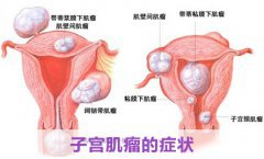 子宫发出的危险信号  整理给30岁左右女性