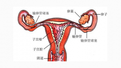 输卵管堵塞怎么办？试试服用妇炎丸！
