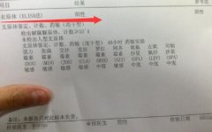 妇炎丸治疗女性衣原体感染