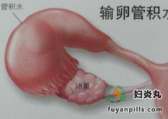 想怀孕却检查出输卵管积水怎么办？切！
