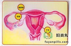 输卵管炎导致女性不孕怎么办?