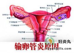 输卵管炎为什么会引起女性不孕