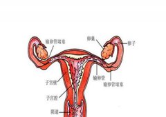 如何治疗近端堵塞