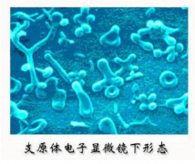 女性支原体感染吃什么药见效快
