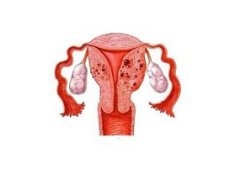 子宫腺肌症中药治疗大概多久见效