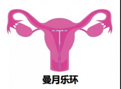 子宫腺肌症什么时候适合上曼月乐环