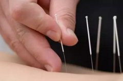 针炙可以治子宫腺肌症吗