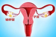 输卵管堵塞有什么办法可以疏通