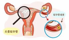 输卵管堵塞怀孕了是不是宫外孕