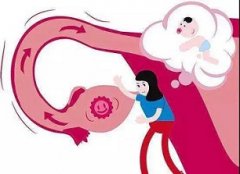 输卵管积水怀孕了影响胎儿吗