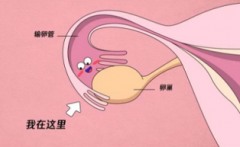 输卵管伞部积水严重吗