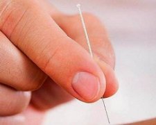 中医治疗输卵管堵塞之针刺疗法