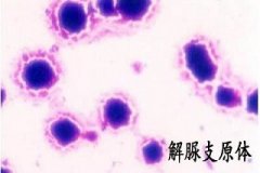 为什么解脲支原体感染会久治不愈