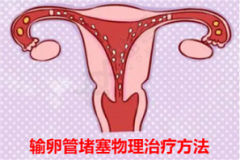 哪些物理疗法可以治疗输卵管堵塞?